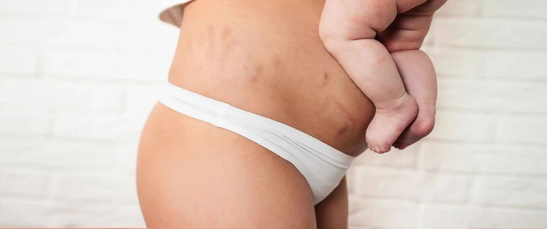 Μετα τη γέννα